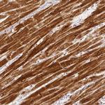 RHOT1 Antibody in Immunohistochemistry (IHC)