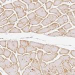 RHOT1 Antibody in Immunohistochemistry (IHC)