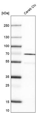 RHOT1 Antibody in Western Blot (WB)