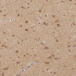 RHOT1 Antibody in Immunohistochemistry (IHC)