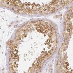 RHOT1 Antibody in Immunohistochemistry (IHC)