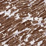 MYH6 Antibody in Immunohistochemistry (IHC)