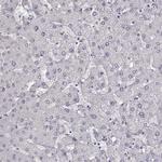 MYH6 Antibody in Immunohistochemistry (IHC)