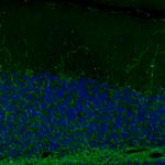 Norepinephrine Transporter Antibody in Immunohistochemistry (IHC)