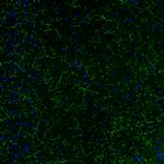 Norepinephrine Transporter Antibody in Immunohistochemistry (IHC)