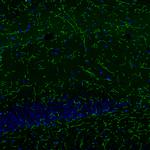 Norepinephrine Transporter Antibody in Immunohistochemistry (IHC)