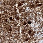 Norepinephrine Transporter Antibody in Immunohistochemistry (IHC)