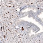 Norepinephrine Transporter Antibody in Immunohistochemistry (IHC)