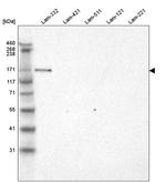 Laminin alpha-3 Antibody in Western Blot (WB)