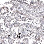 Laminin alpha-2 Antibody in Immunohistochemistry (IHC)