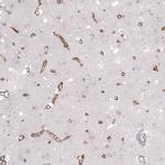 Laminin alpha-2 Antibody in Immunohistochemistry (IHC)