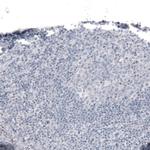 Laminin alpha-2 Antibody in Immunohistochemistry (IHC)