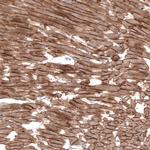 Laminin alpha-2 Antibody in Immunohistochemistry (IHC)