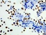 B-Raf (V600E) Antibody in Immunohistochemistry (Paraffin) (IHC (P))