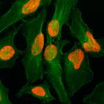 Histone H2A.Z Antibody in Immunocytochemistry (ICC/IF)