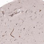 VISTA Antibody in Immunohistochemistry (IHC)