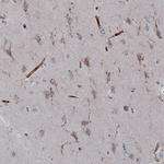 VISTA Antibody in Immunohistochemistry (IHC)