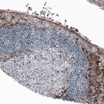 VISTA Antibody in Immunohistochemistry (IHC)