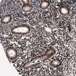 METTL14 Antibody in Immunohistochemistry (IHC)