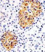 RAB3B Antibody in Immunohistochemistry (Paraffin) (IHC (P))