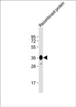 MYO18B Antibody in Western Blot (WB)