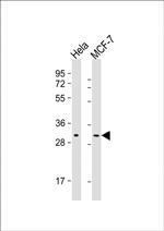 RAB20 Antibody in Western Blot (WB)