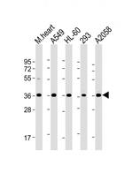 WBP2 Antibody in Western Blot (WB)