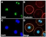 SIAH2 Antibody in Immunocytochemistry (ICC/IF)