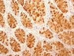 TCCR Antibody in Immunohistochemistry (Paraffin) (IHC (P))