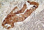 TCCR Antibody in Immunohistochemistry (Paraffin) (IHC (P))