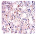 ADFP Antibody in Immunohistochemistry (Paraffin) (IHC (P))