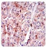 ADFP Antibody in Immunohistochemistry (Paraffin) (IHC (P))