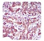 ABCG5 Antibody in Immunohistochemistry (Paraffin) (IHC (P))