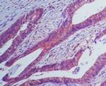 IL23R Antibody in Immunohistochemistry (Paraffin) (IHC (P))