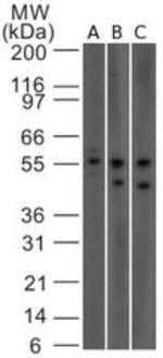 IL23R Antibody in Western Blot (WB)