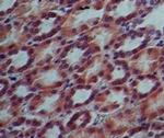 IL17RE Antibody in Immunohistochemistry (Paraffin) (IHC (P))