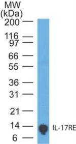 IL17RE Antibody in Western Blot (WB)