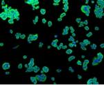 ALPL Antibody in Immunocytochemistry (ICC/IF)