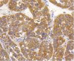 ALPL Antibody in Immunohistochemistry (Paraffin) (IHC (P))