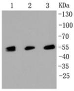 MLKL Antibody in Western Blot (WB)