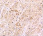 IFNAR1 Antibody in Immunohistochemistry (Paraffin) (IHC (P))