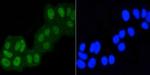 ASH2L Antibody in Immunocytochemistry (ICC/IF)