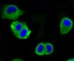 ATP Citrate Lyase Antibody in Immunocytochemistry (ICC/IF)