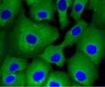 ATP Citrate Lyase Antibody in Immunocytochemistry (ICC/IF)