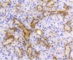 ATP Citrate Lyase Antibody in Immunohistochemistry (Paraffin) (IHC (P))