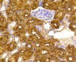 ATP Citrate Lyase Antibody in Immunohistochemistry (Paraffin) (IHC (P))