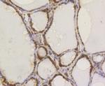 ATP Citrate Lyase Antibody in Immunohistochemistry (Paraffin) (IHC (P))