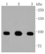 ATP Citrate Lyase Antibody in Western Blot (WB)