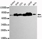 DLAT Antibody in Western Blot (WB)