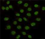 LSD1 Antibody in Immunocytochemistry (ICC/IF)